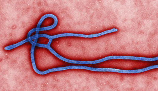 警惕最新病毒病人，你需要了解這些關(guān)鍵信息！